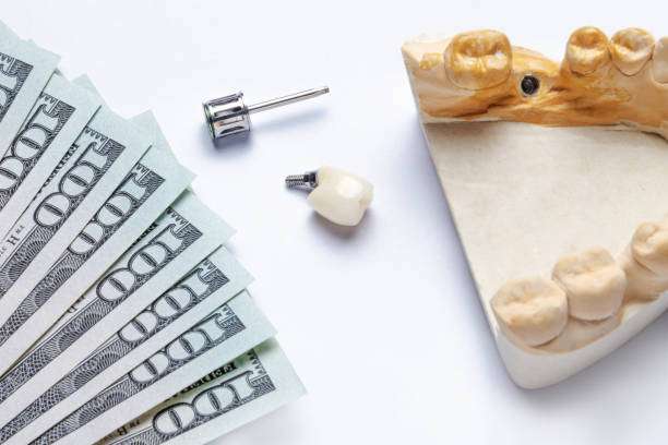 ceramic tooth implant lies with a dental tool and a model of teeth with an implant on a white background. to the left of the tooth are banknotes of dollars. concept of the high cost of dentistry and insurance. raising money for dentistry