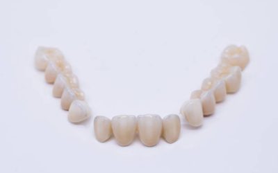 Metal Free Ceramic Dental Crowns. Ceramic zirconium in final version. Staining and glazing. Precision design and high quality materials.
